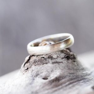 white gold turning yellow